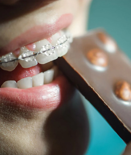 img-life-with-braces-02